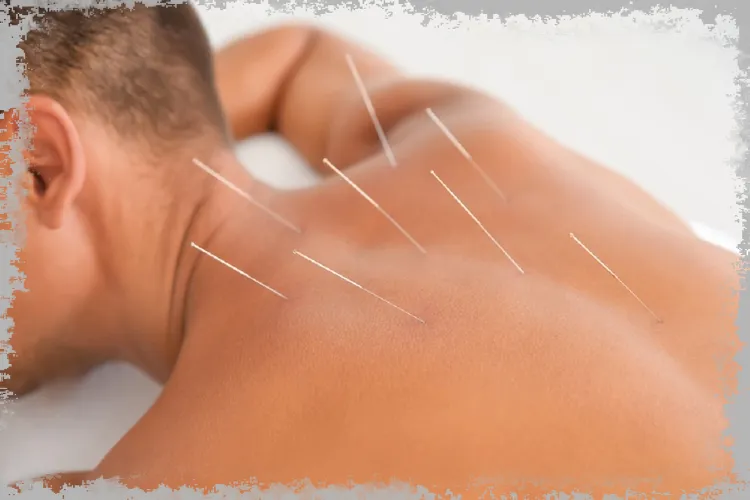 Akupunktura - indikace, kontraindikace a vedlejší účinky